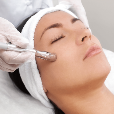 Best Microdermabrasion Facial in Montreal, Quebec, Canada at Lumilaser