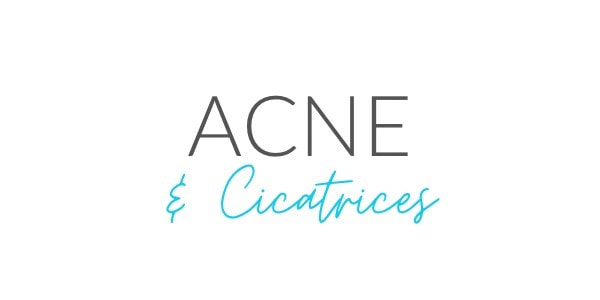Acne, acne marks, acne scars, acne laser treatments in Montreal, Quebec, Lumilaser Esthetics, Eve Mamane 