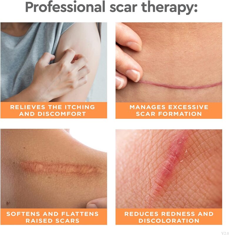  STRATADERM Scar Gel is sold in Canada and online at Lumilaser Esthetics.